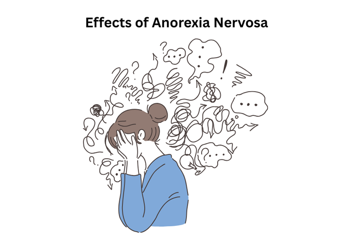 Effects of Anorexia Nervosa in The Long Term